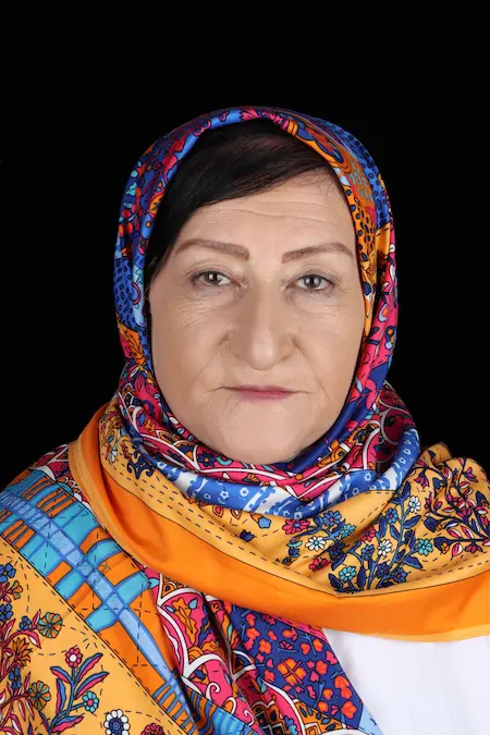 لیفت ابرو بعد