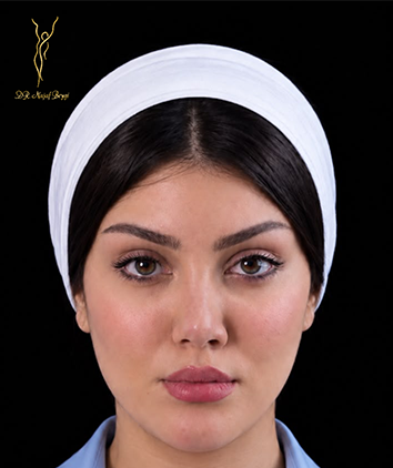 تیسی لیفت؛ راز جوانی ماندگار